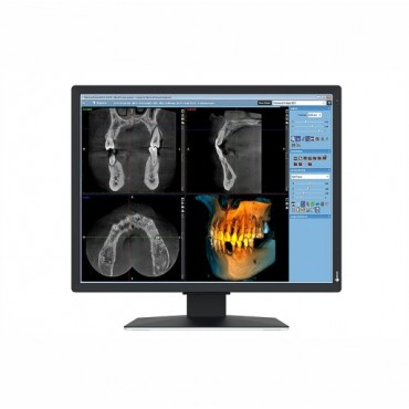 MONITOR REVISIÓN MÉDICA EIZO MX217-SB RADIFORCE