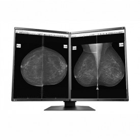 MONITOR MAMOGRAFÍA EIZO GX560-MD RADIFORCE