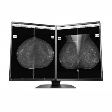 MONITOR MAMOGRAFÍA EIZO GX560-MD RADIFORCE